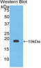 Coagulation Factor VIII antibody, LS-C300222, Lifespan Biosciences, Western Blot image 
