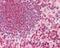 Matrix Metallopeptidase 16 antibody, 49-704, ProSci, Immunohistochemistry frozen image 