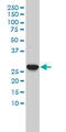 Carbonic Anhydrase 3 antibody, LS-B5379, Lifespan Biosciences, Western Blot image 