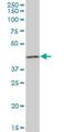 Holocytochrome C Synthase antibody, H00003052-B01P, Novus Biologicals, Western Blot image 