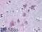 Tripartite Motif Containing 2 antibody, 46-519, ProSci, Western Blot image 