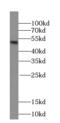 Presenilin 1 antibody, FNab06769, FineTest, Western Blot image 