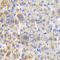 Cbl Proto-Oncogene B antibody, A2014, ABclonal Technology, Immunohistochemistry paraffin image 