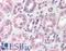 DNA Polymerase Mu antibody, LS-B406, Lifespan Biosciences, Immunohistochemistry paraffin image 