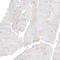 Integrin Subunit Alpha 6 antibody, AMAb91450, Atlas Antibodies, Immunohistochemistry paraffin image 