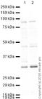 DNA Methyltransferase 3 Beta antibody, ab2851, Abcam, Western Blot image 
