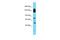 Synapse Defective Rho GTPase Homolog 2 antibody, A14182, Boster Biological Technology, Western Blot image 