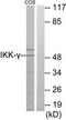 Inhibitor Of Nuclear Factor Kappa B Kinase Regulatory Subunit Gamma antibody, TA311836, Origene, Western Blot image 