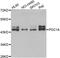 POC1 Centriolar Protein A antibody, A7465, ABclonal Technology, Western Blot image 