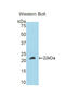 Fibroblast Growth Factor 21 antibody, LS-C293903, Lifespan Biosciences, Western Blot image 