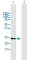 StAR Related Lipid Transfer Domain Containing 5 antibody, H00080765-B02P, Novus Biologicals, Western Blot image 