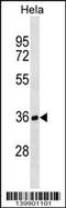 Tubulin Folding Cofactor B antibody, 60-315, ProSci, Western Blot image 