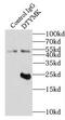 Deoxythymidylate Kinase antibody, FNab02558, FineTest, Immunoprecipitation image 