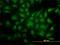 Y-Box Binding Protein 1 antibody, H00004904-M01, Novus Biologicals, Immunocytochemistry image 