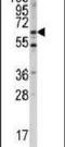 Menin 1 antibody, PA5-14311, Invitrogen Antibodies, Western Blot image 