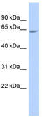 Polypeptide N-Acetylgalactosaminyltransferase 18 antibody, TA331019, Origene, Western Blot image 