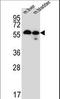 Transmembrane Protein 87B antibody, LS-C162024, Lifespan Biosciences, Western Blot image 