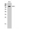 ATP Binding Cassette Subfamily F Member 1 antibody, LS-C381850, Lifespan Biosciences, Western Blot image 