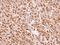 Calreticulin 3 antibody, GTX112177, GeneTex, Immunohistochemistry paraffin image 