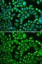 26S proteasome non-ATPase regulatory subunit 7 antibody, GTX54625, GeneTex, Immunocytochemistry image 