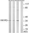 Vomeronasal 1 Receptor 3 (Gene/Pseudogene) antibody, GTX87211, GeneTex, Western Blot image 