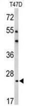 BCL2 Related Protein A1 antibody, GTX82541, GeneTex, Western Blot image 