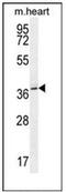 N(Alpha)-Acetyltransferase 30, NatC Catalytic Subunit antibody, AP52813PU-N, Origene, Western Blot image 