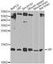 Vasoactive Intestinal Peptide antibody, A1804, ABclonal Technology, Western Blot image 