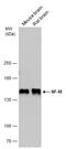 Neurofilament Medium antibody, GTX133218, GeneTex, Western Blot image 