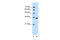 Thymidylate Synthetase antibody, 30-425, ProSci, Enzyme Linked Immunosorbent Assay image 