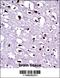 Eukaryotic Translation Elongation Factor 1 Alpha 1 antibody, 62-352, ProSci, Immunohistochemistry frozen image 