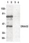 Serine/Threonine Kinase 17b antibody, PA5-19927, Invitrogen Antibodies, Western Blot image 