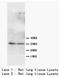 Aquaporin 5 antibody, AP23312PU-N, Origene, Western Blot image 