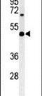 Galactosylgalactosylxylosylprotein 3-beta-glucuronosyltransferase 1 antibody, PA5-26921, Invitrogen Antibodies, Western Blot image 