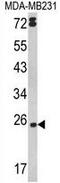 Lymphotoxin Alpha antibody, GTX81207, GeneTex, Western Blot image 