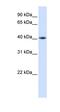 TAR DNA Binding Protein antibody, orb329851, Biorbyt, Western Blot image 