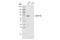 Lymphocyte Cytosolic Protein 2 antibody, 80554S, Cell Signaling Technology, Western Blot image 