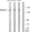 RAD50 Double Strand Break Repair Protein antibody, abx014059, Abbexa, Western Blot image 