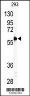 Matrix Metallopeptidase 11 antibody, 62-168, ProSci, Western Blot image 