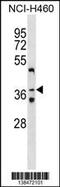 Zinc Finger Protein 691 antibody, 59-867, ProSci, Western Blot image 