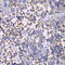 Protein Tyrosine Kinase 2 antibody, LS-C331910, Lifespan Biosciences, Immunohistochemistry paraffin image 