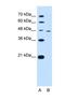 Ring Finger Protein 25 antibody, NBP1-55063, Novus Biologicals, Western Blot image 
