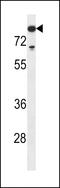 DNA Nucleotidylexotransferase antibody, 57-757, ProSci, Western Blot image 