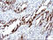 Serpin Family B Member 3 antibody, M04067-1, Boster Biological Technology, Immunohistochemistry paraffin image 