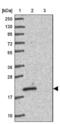 Transmembrane P24 Trafficking Protein 10 antibody, NBP2-48969, Novus Biologicals, Western Blot image 