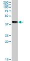 Creatine Kinase, Mitochondrial 1B antibody, H00001159-M16, Novus Biologicals, Western Blot image 