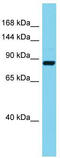 Stromal Interaction Molecule 2 antibody, TA343352, Origene, Western Blot image 