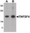 TNF Superfamily Member 4 antibody, PA5-34516, Invitrogen Antibodies, Western Blot image 