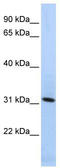 Synaptogyrin 4 antibody, TA341914, Origene, Western Blot image 