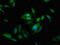 Afadin- and alpha-actinin-binding protein antibody, LS-C672231, Lifespan Biosciences, Immunofluorescence image 